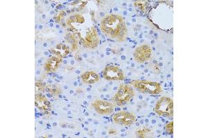 Immunohistochemistry of paraffin-embedded rat kidney using FDPS Antibody (ABIN5973369) at dilution of 1/100 (40x lens). (FDPS 抗体)
