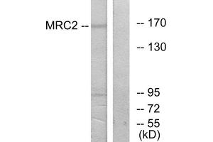 Western Blotting (WB) image for anti-Mannose Receptor, C Type 2 (MRC2) (N-Term) antibody (ABIN1850036) (MRC2 抗体  (N-Term))