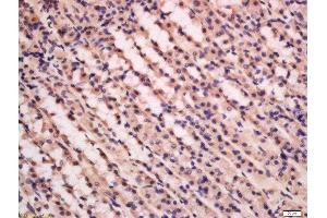 Formalin-fixed and paraffin embedded rat stomach labeled with Anti-PFK2 Polyclonal Antibody, Unconjugated  at 1:200 followed by conjugation to the secondary antibody and DAB staining. (PFKFB3 抗体  (AA 401-520))