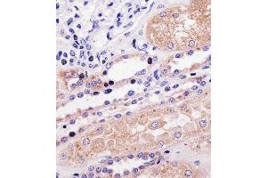 Immunohistochemical analysis of paraffin-embedded H. (PPP2R2A 抗体  (N-Term))