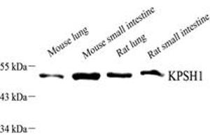 Western blot analysis of PSKH1 (ABIN7075291),at dilution of 1: 1500,Lane 1: Mouse lung tissue lysate,Lane 2: Mouse small intestine tissue lysate,Lane 3: Rat lung tissue lysate,Lane 4: Rat small intestine tissue lysate (PSKH1 抗体)