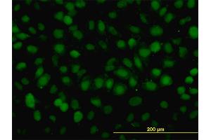 Immunofluorescence of monoclonal antibody to RAD54B on HeLa cell. (RAD54B 抗体  (AA 801-910))