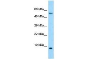 Image no. 1 for anti-S100 Calcium Binding Protein A10 (S100A10) (C-Term) antibody (ABIN6748414)