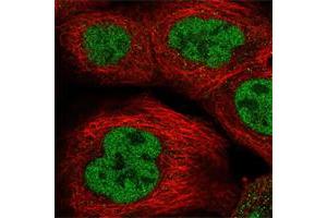 Immunofluorescent staining of human cell line A-431 shows positivity in nucleus but not nucleoli. (RREB1 抗体)