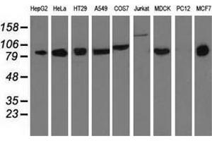 Western blot analysis of extracts (35 µg) from 9 different cell lines by using anti-DGKB monoclonal antibody.