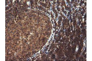 Image no. 6 for anti-Tripartite Motif Containing 44 (TRIM44) antibody (ABIN1501505)