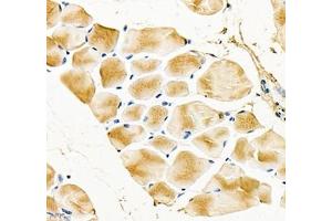Immunohistochemistry of paraffin embedded mouse Skeletal muscle using Igfn1 (ABIN7074278) at dilution of 1:700 (400x lens) (IGFN1 抗体)