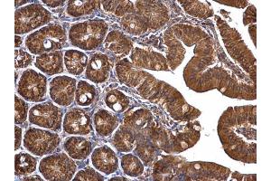 Immunohistochemistry (IHC) image for anti-Tu Translation Elongation Factor, Mitochondrial (Tufm) antibody (ABIN2855160)