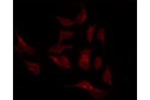 ABIN6275869 staining K562 by IF/ICC. (SLC44A1 抗体  (Internal Region))