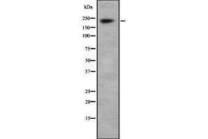Western Blotting (WB) image for anti-Sodium Channel, Voltage-Gated, Type I, alpha Subunit (SCN1A) (Internal Region) antibody (ABIN6263501)