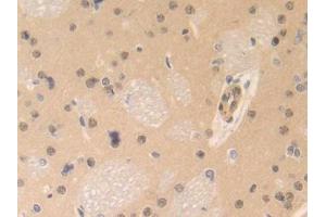 DAB staining on IHC-P; Samples: Rat Brain Tissue (CENPE 抗体  (AA 2222-2361))
