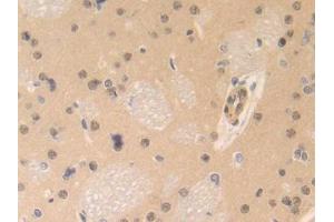 DAB staining on IHC-P; Samples: Rat Brain Tissue