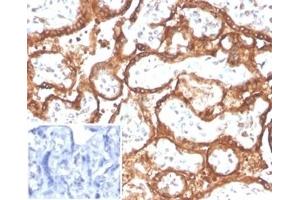 Formalin-fixed, paraffin-embedded human placenta stained with HCG-beta Rabbit Recombinant Monoclonal Antibody (HCGa/2728R). (Recombinant CGA 抗体  (AA 1-100))