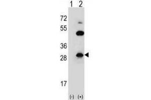 Western blot analysis of CLDN2 (arrow) using rabbit polyclonal CLDN2 Antibody (pTyr224) . (Claudin 2 抗体  (C-Term))