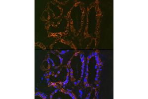 Immunofluorescence (IF) image for anti-Parathyroid Hormone (PTH) antibody (ABIN7269175)