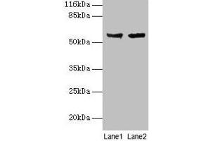 Western blot All lanes: CYP17A1 antibody at 2 μg/mL Lane 1: Hela whole cell lysate Lane 2: A549 whole cell lysate Secondary Goat polyclonal to rabbit IgG at 1/10000 dilution Predicted band size: 58 kDa Observed band size: 58 kDa (CYP17A1 抗体  (AA 1-508))
