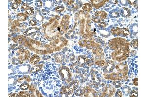 ATIC antibody was used for immunohistochemistry at a concentration of 4-8 ug/ml to stain EpitheliaI cells of renal tubule (arrows) in Human Kidney. (ATIC 抗体  (Middle Region))