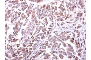 Immunohistochemistry (IHC) image for anti-Killer Cell Lectin-Like Receptor Subfamily K, Member 1 (KLRK1) (Internal Region) antibody (ABIN2855938)