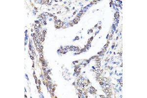 Immunohistochemistry (Paraffin-embedded Sections) (IHC (p)) image for anti-Yes-Associated Protein 1 (YAP1) antibody (ABIN1683302)
