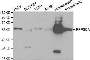 Western blot analysis of extracts of various cell lines, using PPP3CA antibody (ABIN5970422) at 1/1000 dilution. (PPP3CA 抗体)
