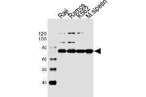 Western blot analysis of lysates from Raji, Ramos, K562 cell line and mouse spleen tissue lysate(from left to right), using BTK Antibody (Center) (ABIN6243554 and ABIN6577451). (BTK 抗体  (AA 396-430))
