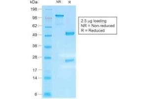 SDS-PAGE Analysis Purified IgG4 Recombinant Rabbit Monoclonal Antibody (IGHG4/2042R). (Recombinant IGHG4 抗体)