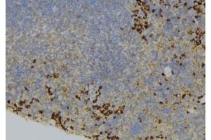 ABIN6273660 at 1/100 staining Human lymph node tissue by IHC-P. (IL-6 Receptor 抗体  (N-Term))