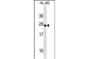 Western blot analysis in HL-60 cell line lysates (35ug/lane). (Homeobox C5 抗体  (C-Term))