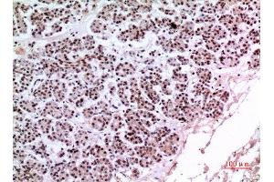 Immunohistochemistry (IHC) analysis of paraffin-embedded Human Pancreas, antibody was diluted at 1:100. (KLF13 抗体)