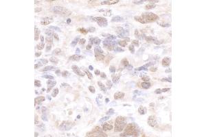 Immunohistochemistry (IHC) image for anti-Cleavage Stimulation Factor, 3' Pre-RNA, Subunit 1, 50kDa (CSTF1) (AA 75-125) antibody (ABIN7453410)