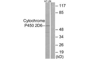 Western Blotting (WB) image for anti-Cytochrome P450, Family 2, Subfamily D, Polypeptide 6 (CYP2D6) (Internal Region) antibody (ABIN1850356) (CYP2D6 抗体  (Internal Region))