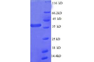50S Ribosomal Protein L27 (AA 2-85), (full length) protein (GST tag)