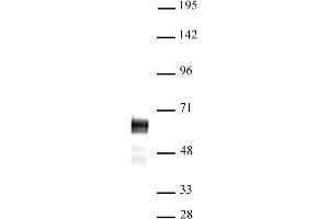 N-Myc antibody (pAb) tested by Western blot. (MYCN 抗体  (C-Term))