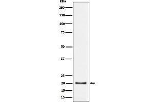Western blot analysis of CSN8 expression in HepG2 cell lysate.