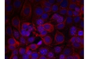 Immunofluorescence staining of methanol-fixed MCF cells using HER2(Phospho-Tyr1221/Tyr1222) Antibody. (ErbB2/Her2 抗体  (pTyr1221, pTyr1222))