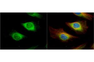 ICC/IF Image Creatine kinase (brain) antibody [N1C1] detects Creatine kinase (brain) protein at cytoplasm and nucleus by immunofluorescent analysis. (CKB 抗体)