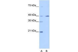 WB Suggested Anti-NR2F2 Antibody Titration: 0. (NR2F2 抗体  (N-Term))