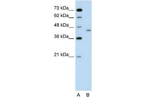 WB Suggested Anti-LRP2BP Antibody Titration:  0. (LRP2BP 抗体  (Middle Region))
