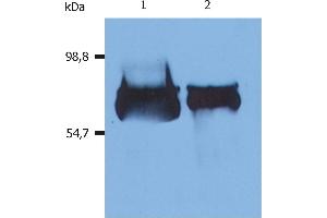 Western Blotting analysis (reducing conditions) of human serum albumin using anti-human Albumin (AL-01). (Albumin 抗体  (Biotin))