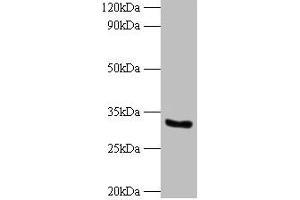 Western blot All lanes: CYB5R3 antibody at 2 μg/mL + 293T whole cell lysate Secondary Goat polyclonal to rabbit IgG at 1/10000 dilution Predicted band size: 35, 32, 39 kDa Observed band size: 32 kDa