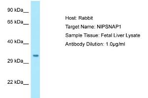 Western Blotting (WB) image for anti-4-Nitrophenylphosphatase Domain and Non-Neuronal SNAP25-Like Protein Homolog 1 (NIPSNAP1) (C-Term) antibody (ABIN2790155) (NIPSNAP1 抗体  (C-Term))