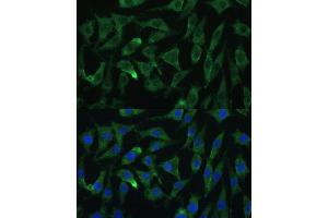Immunofluorescence analysis of L929 cells using Argonaute-2 Polyclonal Antibody (ABIN6127880, ABIN6140046, ABIN6140048 and ABIN6222548) at dilution of 1:100 (40x lens).