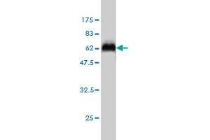 Western Blotting (WB) image for anti-serine/threonine Kinase 16 (STK16) (AA 1-305) antibody (ABIN563708)