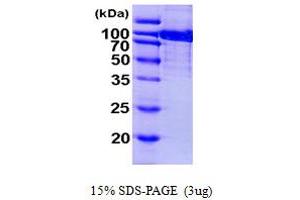 SDS-PAGE (SDS) image for Aconitase 1 (ACO1) (AA 1-889) protein (His tag) (ABIN667323) (Aconitase 1 Protein (ACO1) (AA 1-889) (His tag))