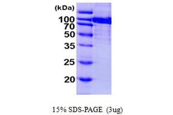 Aconitase 1 Protein (ACO1) (AA 1-889) (His tag)
