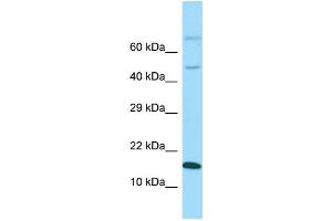 Western Blotting (WB) image for anti-GABA(A) Receptor-Associated Protein Like 1 (GABARAPL1) (Middle Region) antibody (ABIN2774240) (GABARAPL1 抗体  (Middle Region))