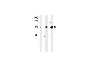 Western blot analysis in PC-3 cell line, mouse testis and zebra fish brain tissue lysates (35ug/lane). (DMRTA2 抗体  (C-Term))