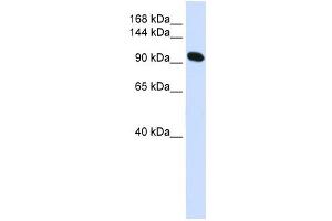 Alpha Actinin 2 antibody used at 1 ug/ml to detect target protein.