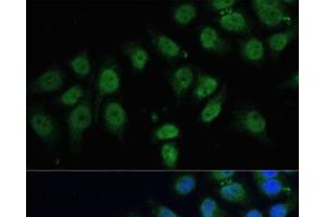 Immunofluorescence analysis of HeLa cells using CPS1 Polyclonal Antibody at dilution of 1:100 (40x lens). (CPS1 抗体)