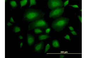 Immunofluorescence (IF) image for anti-Ankyrin Repeat and Sterile alpha Motif Domain Containing 1A (ANKS1A) (AA 1-460) antibody (ABIN525077)